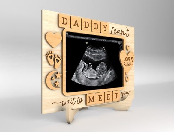Custom Baby Ultrasound Photo Plaque – Personalised Gift for Dad-to-Be
