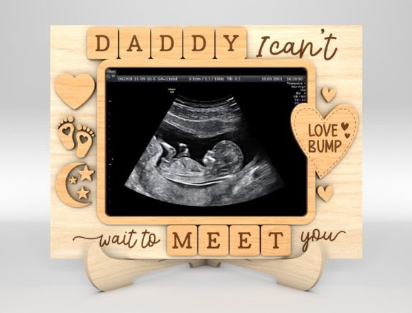 Custom Baby Ultrasound Photo Plaque – Personalised Gift for Dad-to-Be