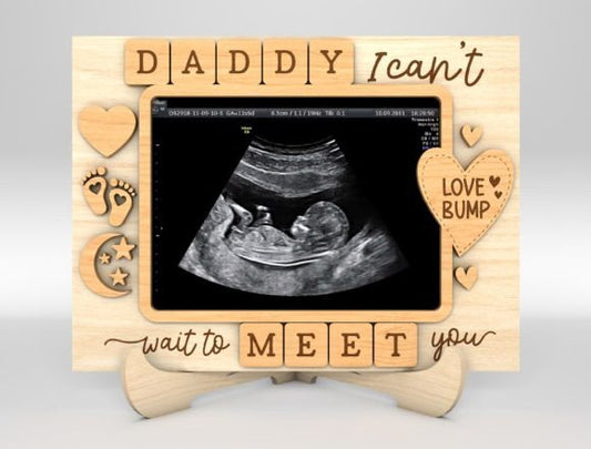 Custom Baby Ultrasound Photo Plaque – Personalised Gift for Dad-to-Be